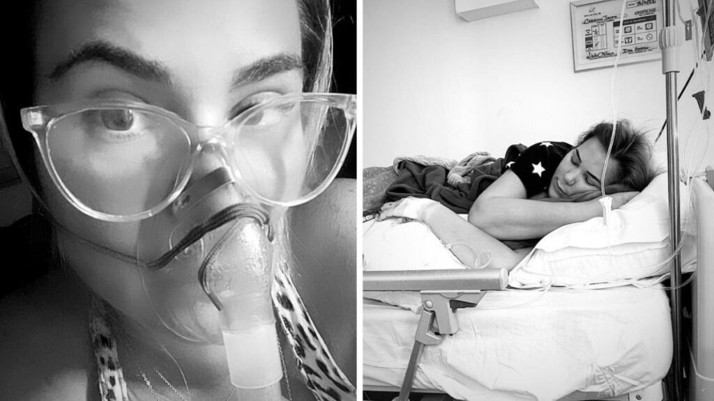 Radiografía de tráquea inflamada por traqueítis bacteriana con secreción purulenta visible en endoscopia