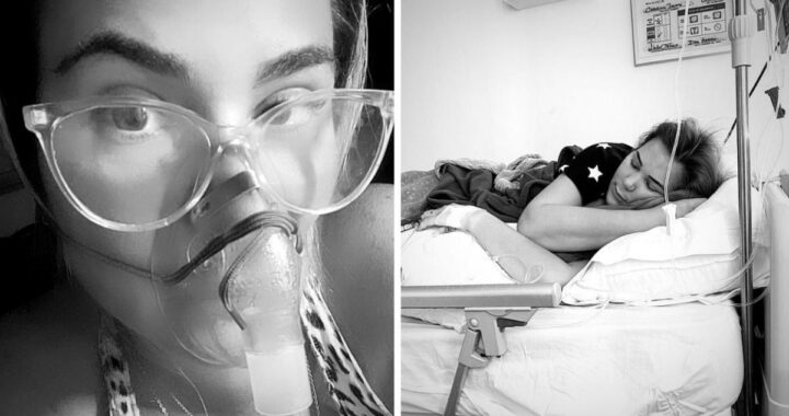 Radiografía de tráquea inflamada por traqueítis bacteriana con secreción purulenta visible en endoscopia
