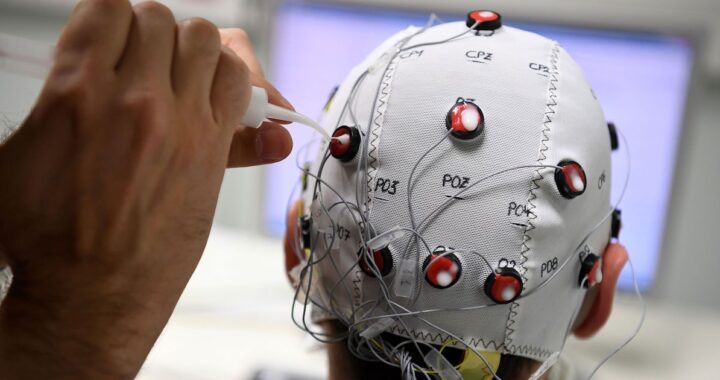 China aprueba el primer implante cerebral para uso comercial